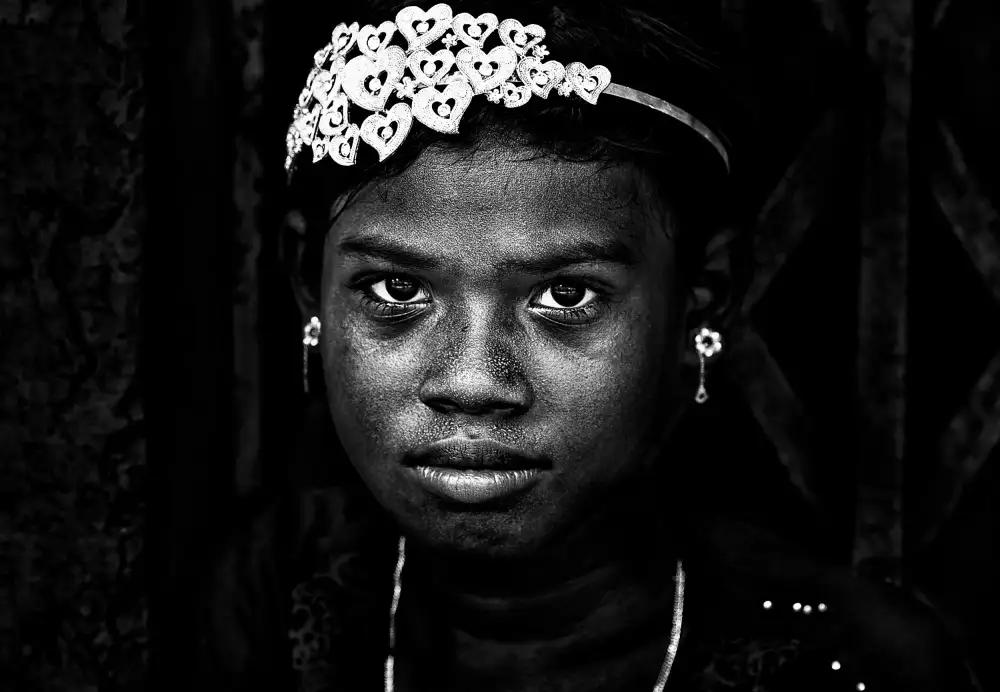 Garmendia, Inazio Joxe: Rohingya refugee girl dressed to celebrate Eid Mubarak.