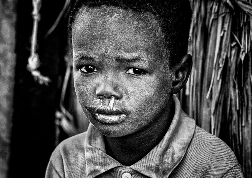 Garmendia, Inazio Joxe: El Molo ethnic child