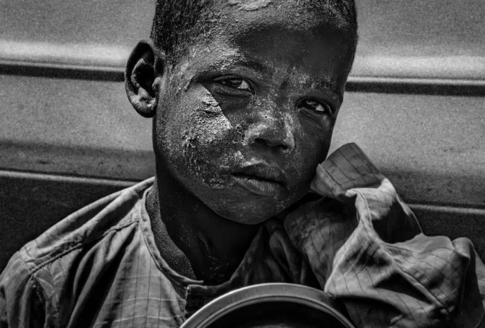 Garmendia, Inazio Joxe: Niño pidiendo ayuda en las calles del Congo