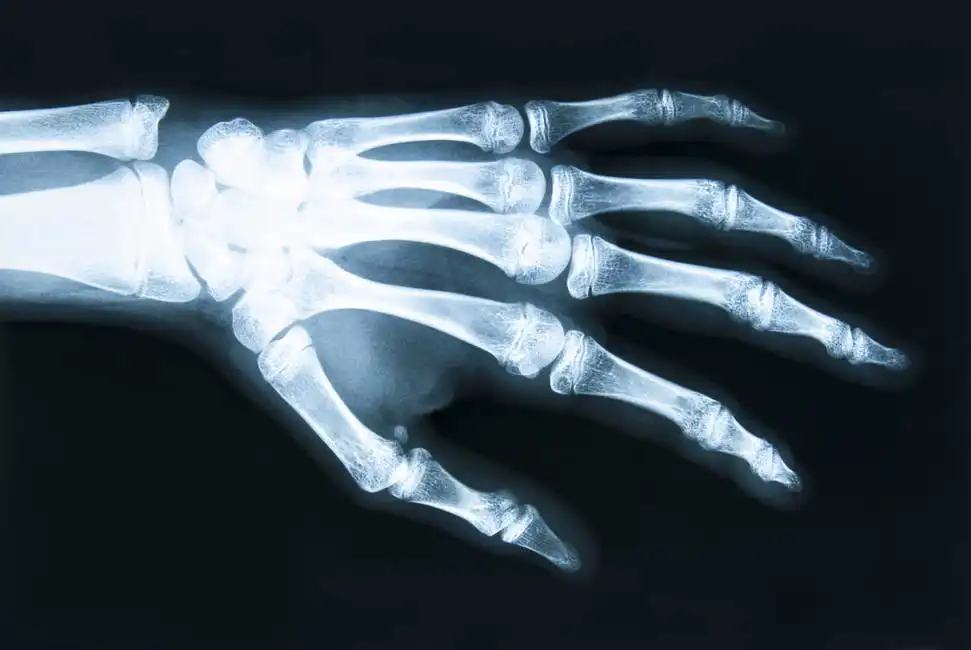 Unknown: Radiograph of a human hand