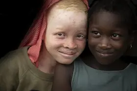 Molina, Elena: Albino children around the mosque in the city of Bouake