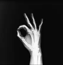 Unknown: Human hand